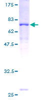 ACADL Protein - 12.5% SDS-PAGE of human ACADL stained with Coomassie Blue