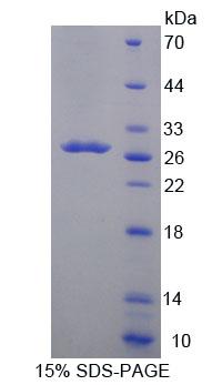 ACADL Protein - Recombinant Acyl Coenzyme A Dehydrogenase, Long Chain (ACADL) by SDS-PAGE