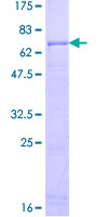 ACADSB Protein - 12.5% SDS-PAGE of human ACADSB stained with Coomassie Blue