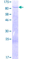 ACADVL Protein - 12.5% SDS-PAGE of human ACADVL stained with Coomassie Blue