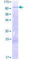 ACADVL Protein - 12.5% SDS-PAGE of human ACADVL stained with Coomassie Blue