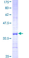 ACADVL Protein - 12.5% SDS-PAGE Stained with Coomassie Blue