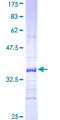 ACADVL Protein - 12.5% SDS-PAGE Stained with Coomassie Blue