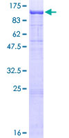 ACAN / Aggrecan Protein - 12.5% SDS-PAGE of human ACAN stained with Coomassie Blue