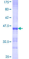 ACAN / Aggrecan Protein - 12.5% SDS-PAGE Stained with Coomassie Blue.