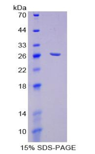 ACAN / Aggrecan Protein - Recombinant Aggrecan (AGC) by SDS-PAGE