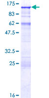 ACAP2 / Centaurin Beta 2 Protein - 12.5% SDS-PAGE of human CENTB2 stained with Coomassie Blue