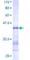 ACAP2 / Centaurin Beta 2 Protein - 12.5% SDS-PAGE Stained with Coomassie Blue.