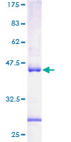 ACAT1 Protein - 12.5% SDS-PAGE of human ACAT1 stained with Coomassie Blue