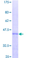 ACAT1 Protein - 12.5% SDS-PAGE of human ACAT1 stained with Coomassie Blue