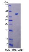 ACAT1 Protein - Recombinant Acetyl Coenzyme A Acetyltransferase 1 (ACAT1) by SDS-PAGE
