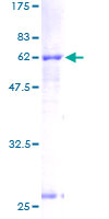 ACAT2 Protein - 12.5% SDS-PAGE of human ACAT2 stained with Coomassie Blue