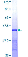 ACAT2 Protein - 12.5% SDS-PAGE Stained with Coomassie Blue.