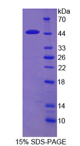ACAT2 Protein - Recombinant Acetyl Coenzyme A Acetyltransferase 2 By SDS-PAGE