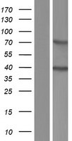 ACBD4 Protein - Western validation with an anti-DDK antibody * L: Control HEK293 lysate R: Over-expression lysate