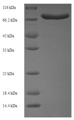 ACBD5 Protein - (Tris-Glycine gel) Discontinuous SDS-PAGE (reduced) with 5% enrichment gel and 15% separation gel.