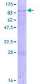 ACBD5 Protein - 12.5% SDS-PAGE of human ACBD5 stained with Coomassie Blue