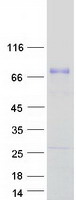 ACBD5 Protein - Purified recombinant protein ACBD5 was analyzed by SDS-PAGE gel and Coomassie Blue Staining