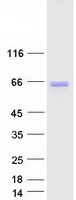 ACBD5 Protein - Purified recombinant protein ACBD5 was analyzed by SDS-PAGE gel and Coomassie Blue Staining