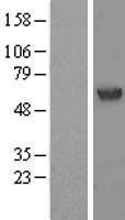 ACCS / ACS Protein - Western validation with an anti-DDK antibody * L: Control HEK293 lysate R: Over-expression lysate