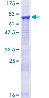 ACCS / ACS Protein - 12.5% SDS-PAGE of human PHACS stained with Coomassie Blue