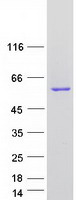 ACCS / ACS Protein - Purified recombinant protein ACCS was analyzed by SDS-PAGE gel and Coomassie Blue Staining