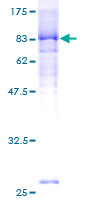 ACD / PTOP Protein - 12.5% SDS-PAGE of human ACD stained with Coomassie Blue