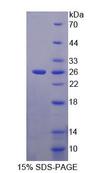 ACD / PTOP Protein - Recombinant Adrenocortical Dysplasia Homolog (ACD) by SDS-PAGE