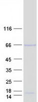 ACD / PTOP Protein - Purified recombinant protein ACD was analyzed by SDS-PAGE gel and Coomassie Blue Staining