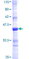 ACE / CD143 Protein - 12.5% SDS-PAGE Stained with Coomassie Blue.