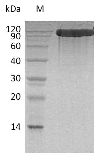 ACE2 / ACE-2 Protein - (Tris-Glycine gel) Discontinuous SDS-PAGE (reduced) with 5% enrichment gel and 15% separation gel.