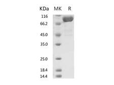 ACE2 / ACE-2 Protein - Recombinant Human ACE2 Protein (His Tag)-Elabscience