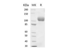 ACE2 / ACE-2 Protein - Recombinant Human ACE2 Protein (His Tag)