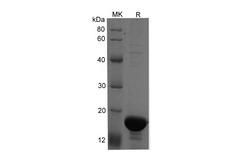 ACE2 / ACE-2 Protein - Recombinant Human ACE2 (596K-740S) Protein (His Tag)