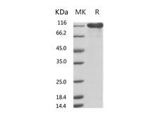 ACE2 / ACE-2 Protein - Recombinant Human ACE2 Protein (mFc Tag)-Elabscience