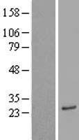 ACER1 / ASAH3 Protein - Western validation with an anti-DDK antibody * L: Control HEK293 lysate R: Over-expression lysate