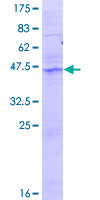 ACER2 Protein - 12.5% SDS-PAGE of human ASAH3L stained with Coomassie Blue