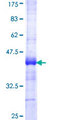 Acetyl-CoA Carboxylase / ACC Protein - 12.5% SDS-PAGE Stained with Coomassie Blue.