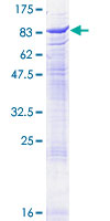 ACHE / Acetylcholinesterase Protein - 12.5% SDS-PAGE of human ACHE stained with Coomassie Blue
