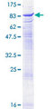 ACHE / Acetylcholinesterase Protein - 12.5% SDS-PAGE of human ACHE stained with Coomassie Blue