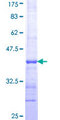 ACHE / Acetylcholinesterase Protein - 12.5% SDS-PAGE Stained with Coomassie Blue.