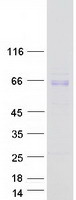 ACHE / Acetylcholinesterase Protein - Purified recombinant protein ACHE was analyzed by SDS-PAGE gel and Coomassie Blue Staining