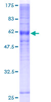 ACKR1 / DARC Protein - 12.5% SDS-PAGE of human FY stained with Coomassie Blue