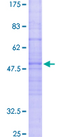 ACKR2 / CCR10 / D6 Protein - 12.5% SDS-PAGE of human CCBP2 stained with Coomassie Blue