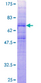 ACKR2 / CCR10 / D6 Protein - 12.5% SDS-PAGE of human CCBP2 stained with Coomassie Blue