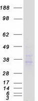 ACKR2 / CCR10 / D6 Protein - Purified recombinant protein ACKR2 was analyzed by SDS-PAGE gel and Coomassie Blue Staining