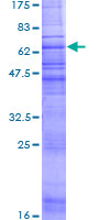 ACKR4 / CCRL1 / CCR11 Protein - 12.5% SDS-PAGE of human CCRL1 stained with Coomassie Blue