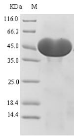 ACLY / ATP Citrate Lyase Protein - (Tris-Glycine gel) Discontinuous SDS-PAGE (reduced) with 5% enrichment gel and 15% separation gel.