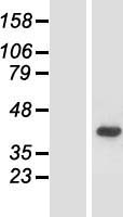 ACMSD Protein - Western validation with an anti-DDK antibody * L: Control HEK293 lysate R: Over-expression lysate