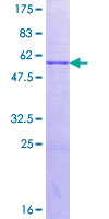 ACMSD Protein - 12.5% SDS-PAGE of human ACMSD stained with Coomassie Blue